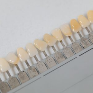 Understanding Dental Coverage Boundaries for Cosmetic Dentistry Insurance Foreign Residents